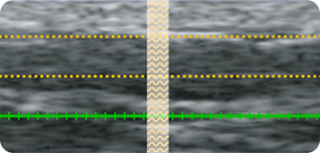 STEP 02